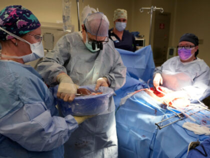 Dr. Marty Sellers hands the liver of an organ donor to LPN scrub nurse Ashton Conrad, left