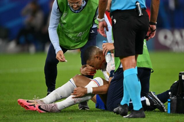 Mbappe breaks nose in France Euro 2024 win - Breitbart