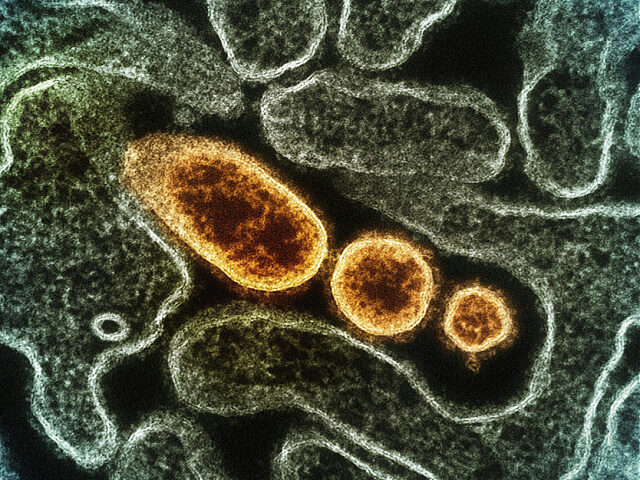 Nipah Virus Particles Colorized transmission electron micrograph of mature extracellular N