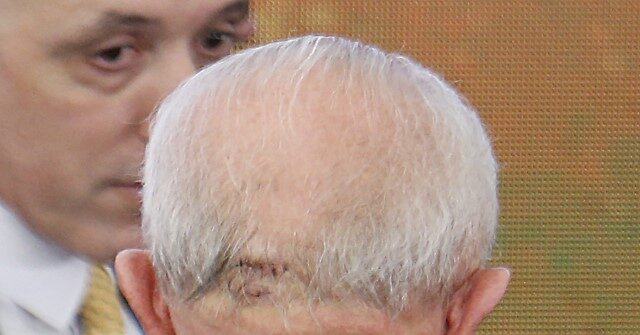 Venezuela Claims Brazil’s Socialist President Faked Head Injury