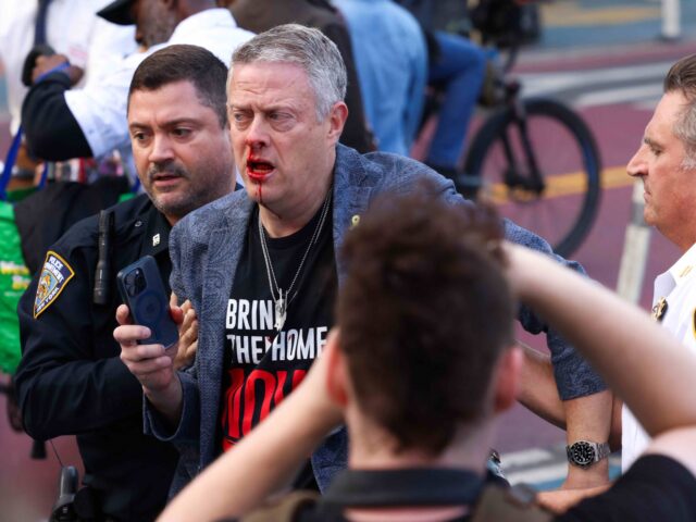 A man bleeds after a fight with a pro-Palestinian demonstrator during a pro-Palestinian ra