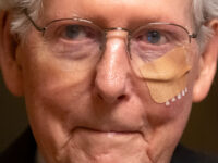 Mitch McConnell Appears Bruised, Bandaged After Latest Fall at Capitol