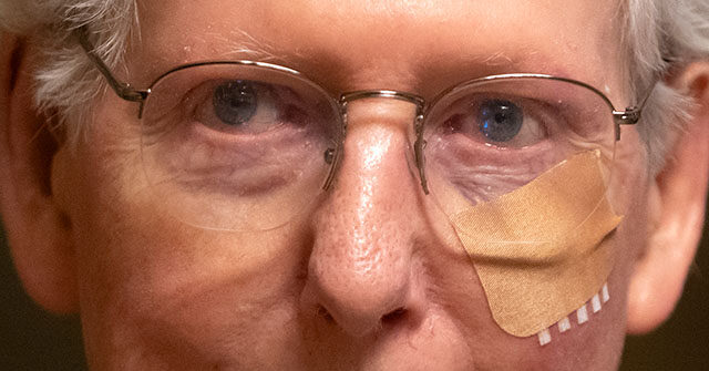 Mitch McConnell Appears Bruised, Bandaged After Latest Fall at Capitol