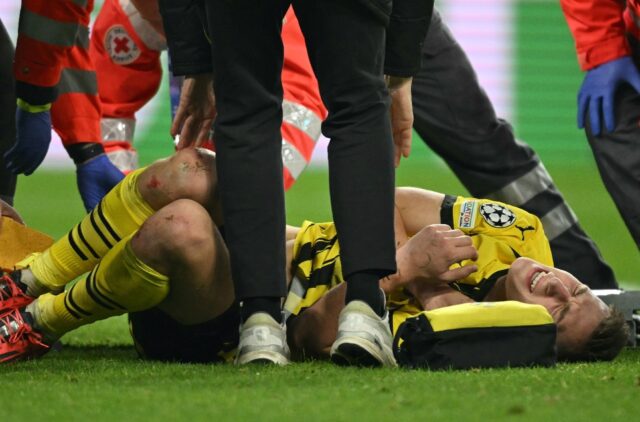 Borussia Dortmund defender Nico Schlotterbeck was stretchered off the pitch with an appare