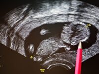 U.S. Bishops: Abortion ‘Destroys over a Million Lives’ Each Year