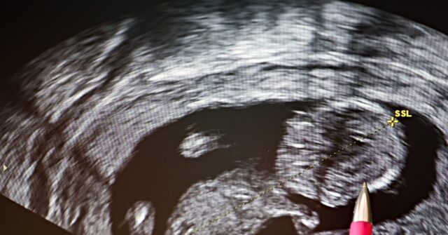 U.S. Bishops: Abortion ‘Destroys over a Million Lives’ Each Year