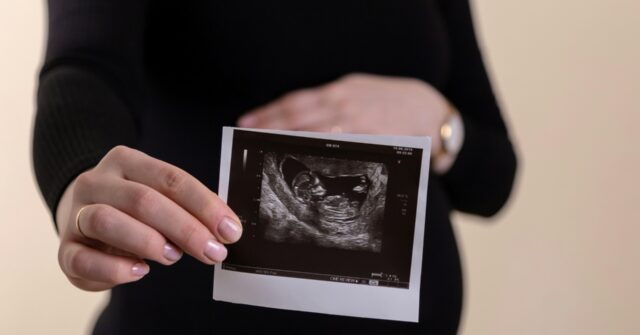 Abortion Was Leading Global Cause of Death in 2024 with over 45 Million Killed