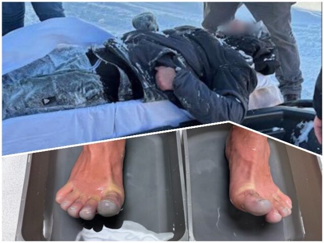 Illegal Alien from Spain Suffers Frostbite at Canadian Border Crossing Illegal Alien from Spain Suffers Frostbite at Canadian Border Crossing (U.S. Border Patrol