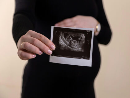 Cropped image of young pregnant woman holding ultrasound picture on belly.