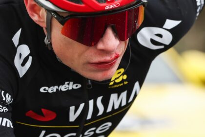 Jonas Vingegaard badly cut his lip in a fall on the fifth stage of the Paris-Nice