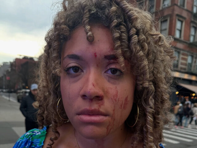 Savannah Craven Assaulted, Facebook/@Savannah Craven
