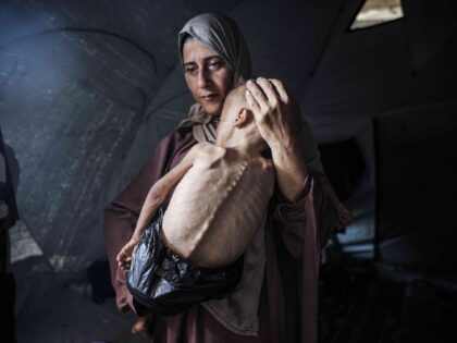 GAZA CITY, GAZA - JULY 21: Muhammad Zakariya Ayyoub al-Matouq, a 1.5-year-old child in Gaz