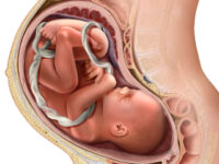 Clinic Opens in Chicago Offering Third Trimester Abortions