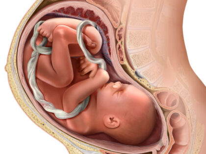 Clinic Opens in Chicago Offering Third Trimester Abortions