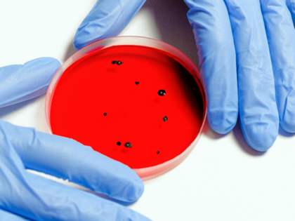 Scientist Holding Petri Dish