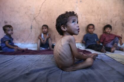 'We are now witnessing a deadly surge in malnutrition-related deaths,' said Tedr