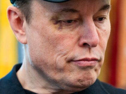 Elon Musk shows off his shiner