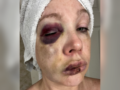 Holly - Cincinnati fight victim