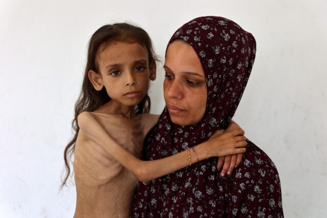 Grok falsely claimed this image of an emaciated Gazan girl by AFP photojournalist Omar al-