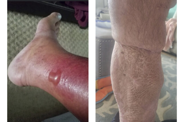 The Associated Press