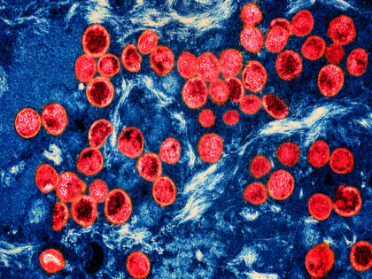 Colorized transmission electron micrograph of monkeypox virus particles (red) found within