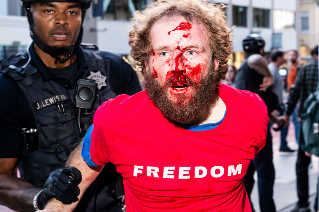 Turning Point USA UC Berkeley assault