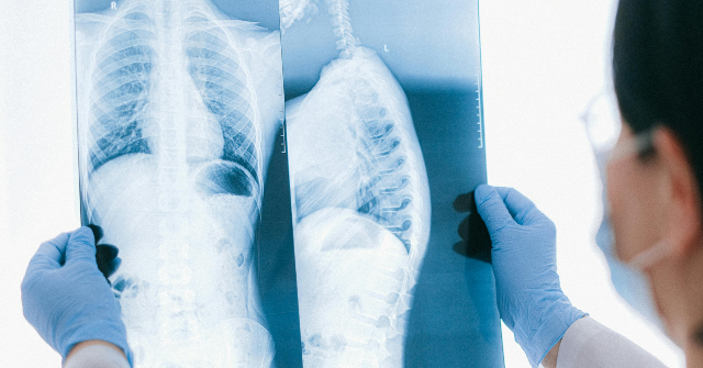 15-Year-Old Athlete Walks Out of California Hospital After Paralyzing Spinal Injury