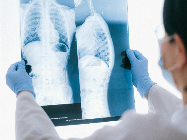 A Doctor Holding an X-ray Result