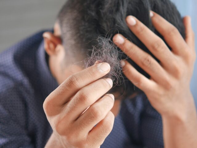 hair loss treatment
