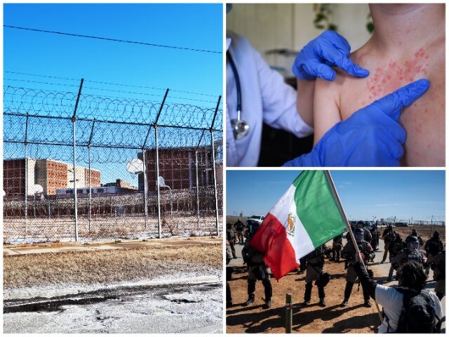 Texas ICE Facility Placed Under Quarantine After Measles Cases Confirmed Among Illegal Ali