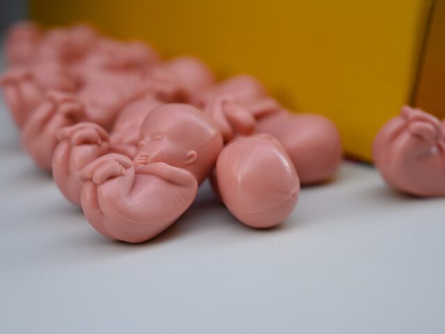 Plastic fetuses are pictured during a pro-life rally in Warsaw, Poland, on March 29, 2025.