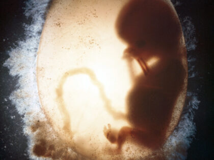 Human fetus enclosed in the amniotic sac during the eleventh week of development Photo by