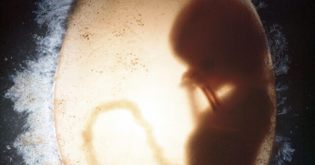 Wyoming Governor Signs Bill Restricting Abortion Once Fetal Heartbeat Is Detected