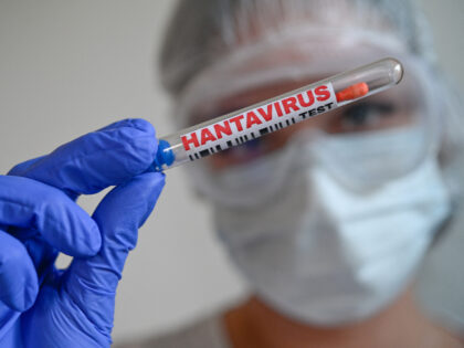 ILLUSTRATION of laboratory hantavirus testing concept with sample tubes and cotton swabs h