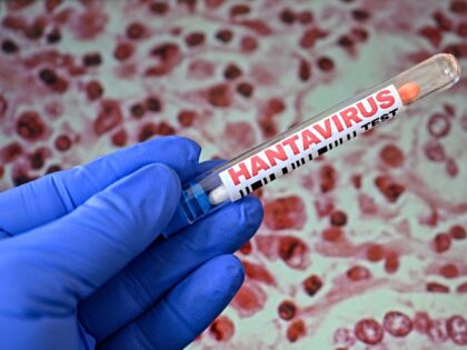 ILLUSTRATION of hantavirus testing concept with laboratory tubes containing cotton swabs a