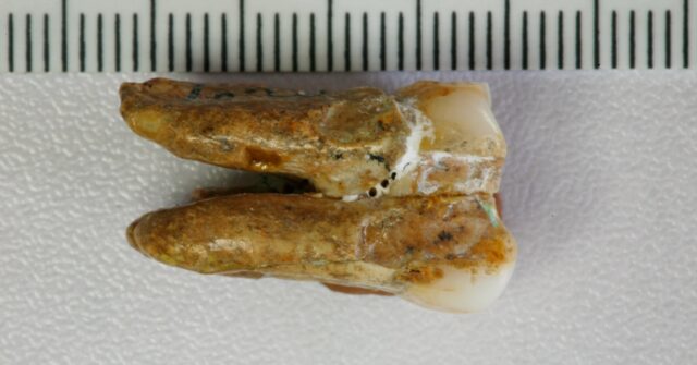 Ancient teeth hint at canoodling between early human relatives - Breitbart