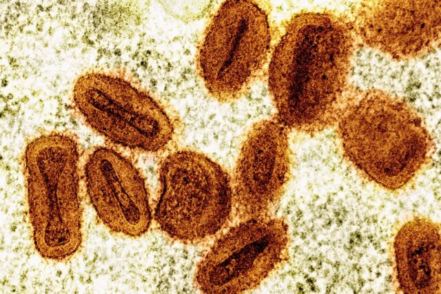 Scientists Charged Mpox The Associated Press