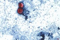 Michigan Reports the First 2 U.S. Deaths Related to a Diarrhea-Causing Parasite