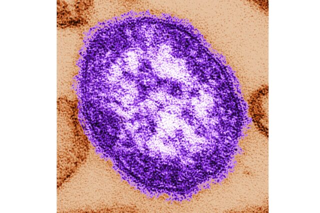 Measles Deaths The Associated Press