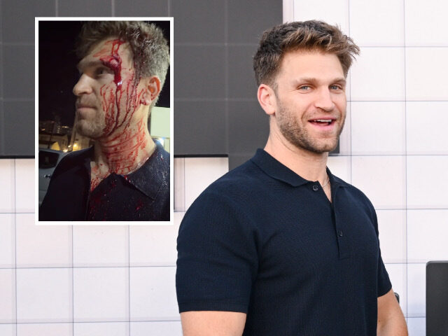 ‘Pretty Little Liars’ Star Keegan Allen Robbed at Gunpoint Outside Luxury Hollywood Grocery Sto