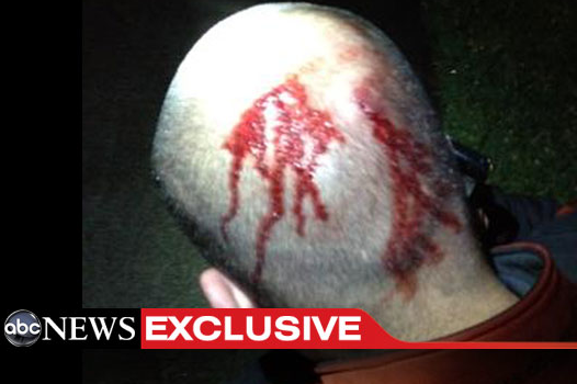 New Photo: Zimmerman's Head Bloody, Bruised, Battered