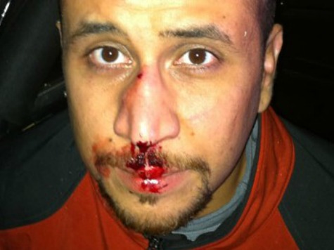 Neighbor: Zimmerman's Nose Disfigured After Fight with Martin