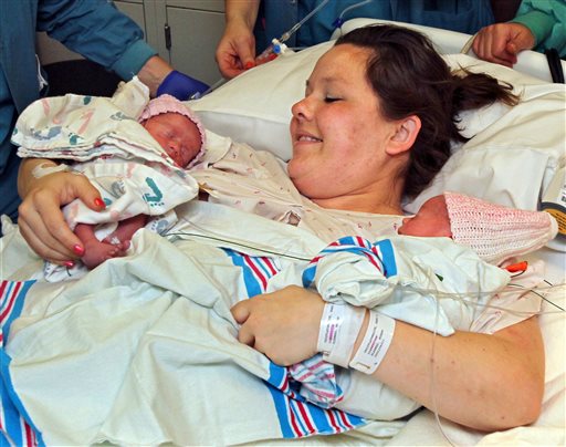 Rare 'mono mono' newborn twins doing well in Ohio