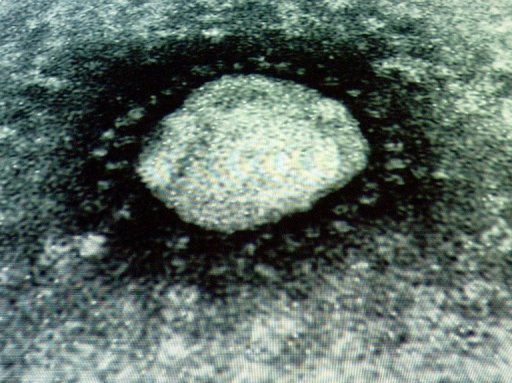 Fourth Case of SARS-Like Virus Hits Britain