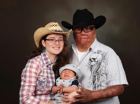 Marine Disfigured by Iraqi IED Deserves Our Gratitude