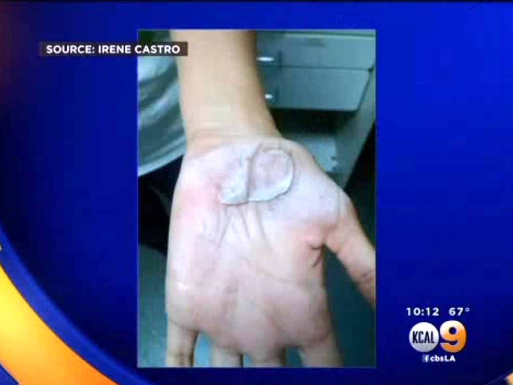 Volleyball Coach Fired After Players Burned in Practice on Hot Pavement