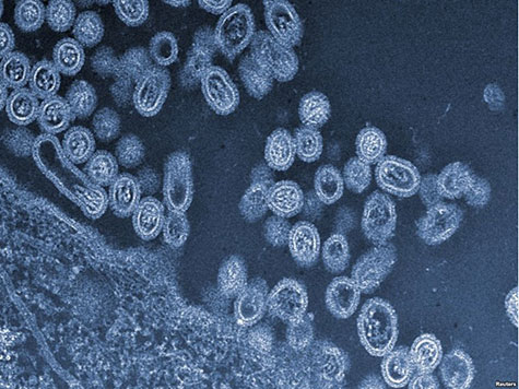 Enterovirus D68 May Link to Paralysis, Spreads in California