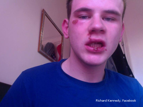 Student Admits Making up 'Homophobic Attack'