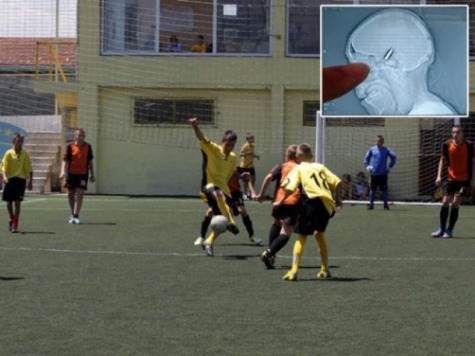 Goalkeeper Plays 90-Minute Soccer Game with Bullet Lodged in Head