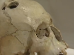 London Exhibit Looks Inside Skulls